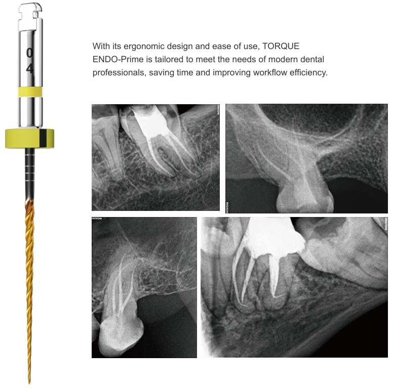 Torque Endo Prime File